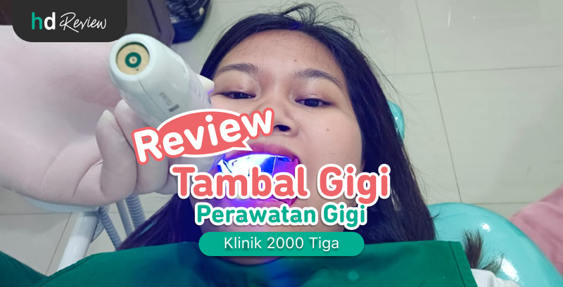 Review Tambal Gigi di Klinik 2000 Tiga, Senyum Lebih Pede tanpa Gigi Berlubang, penambalan gigi