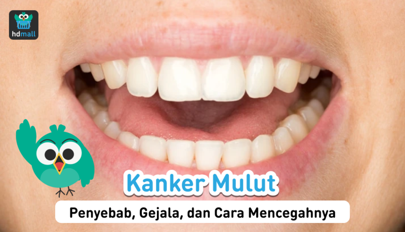 Kanker Mulut Kanker Mulut