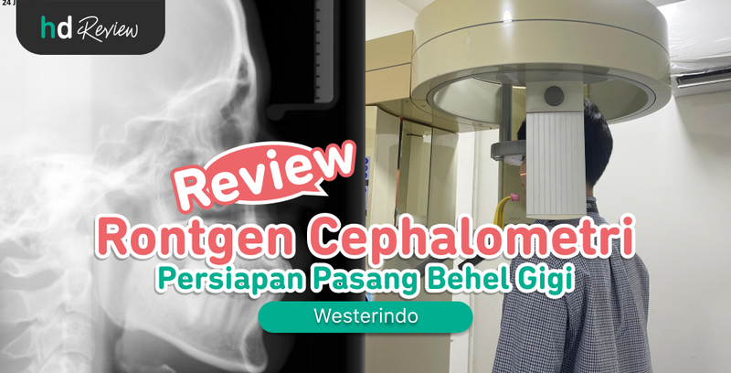 Review Rontgen Cephalometri di Westerindo untuk Lihat Struktur Gigi Jelang Pasang Behel, rontgen gigi, sefalometri