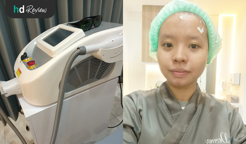 Alat rejuvenation laser di Derma Express