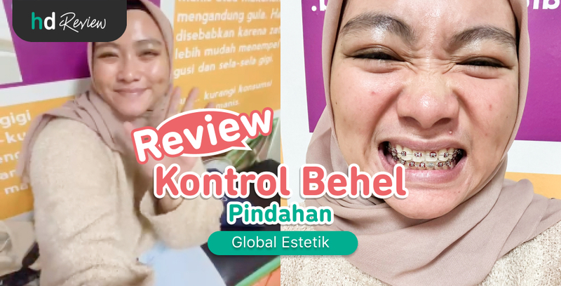 Review Kontrol Behel Pindahan di Global Estetik, Konsisten Jaga Kondisi Gigi Biar Rapi