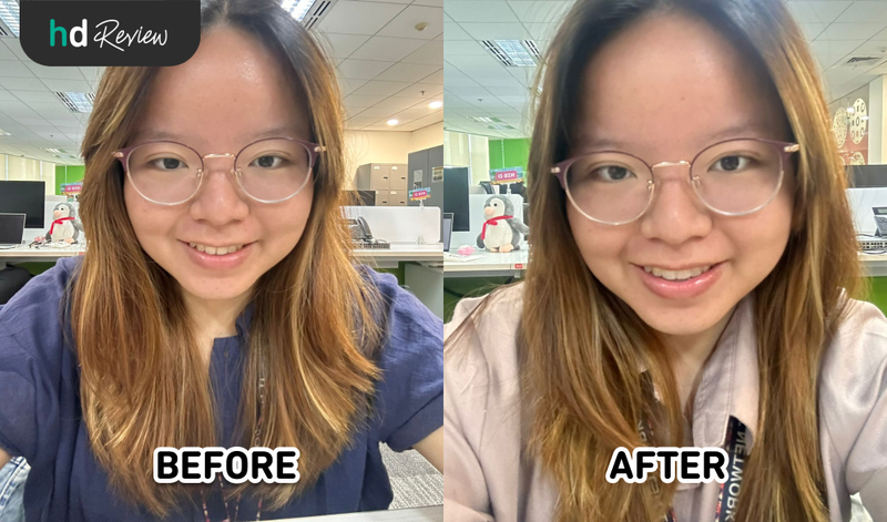 Foto before after pakai retainer lepasan clear