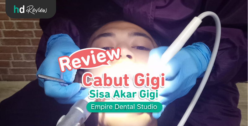 Review Cabut Gigi di Empire Dental Studio, Buang Gigi Rusak yang Bikin Nyeri