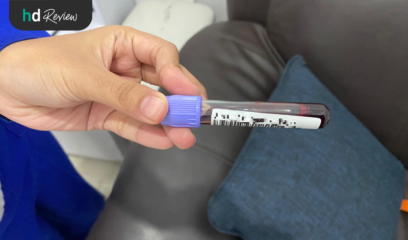 Sampel darah untuk tes VDRL di Pertama Lab Sampel darah untuk tes VDRL di Pertama Lab