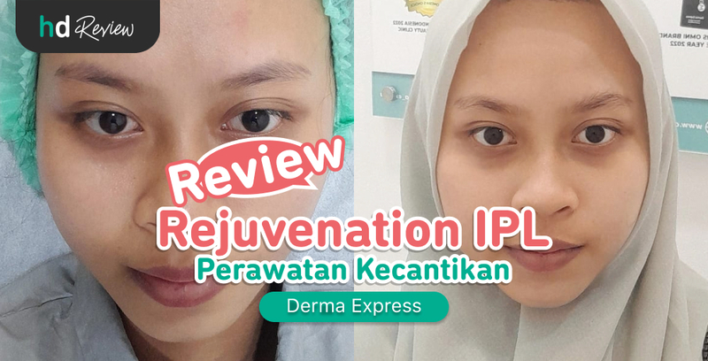 Review Rejuvenation IPL di Derma Express, Bikin Wajah Cerah dan Enteng! Review Rejuvenation IPL di Derma Express, Bikin Wajah Cerah dan Enteng!