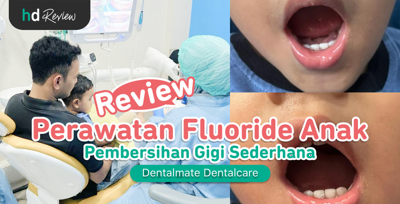 Review Perawatan Fluoride Anak di Dentalmate Dentalcare, Biar Gigi Si Kecil Sehat dan Bebas Gigi Berlubang