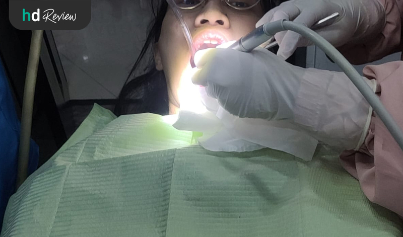 Proses scaling gigi di Global Estetik