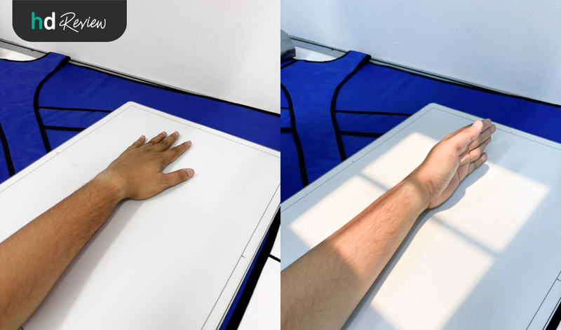 Prosedur rontgen pergelangan tangan di Biomedilab