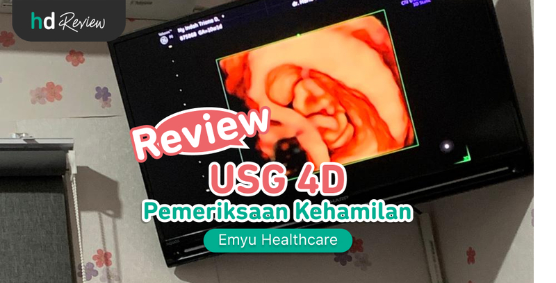 Review USG 4D di Emyu Healthcare