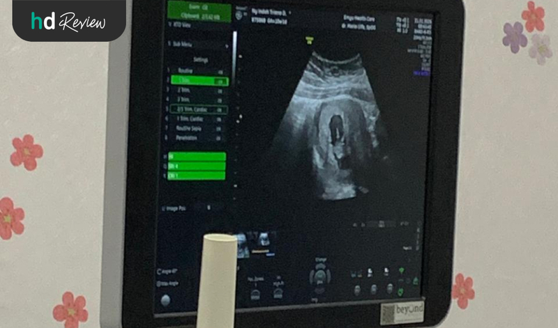 Hasil USG 2D di Emyu Healthcare